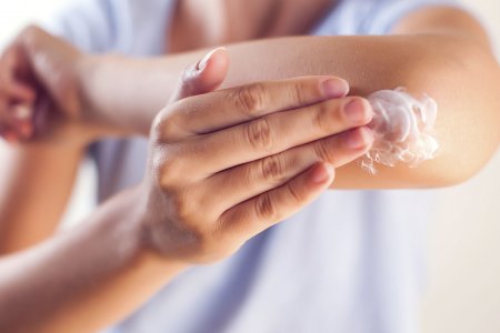 Eczema cream for adults